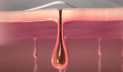 Sinchon Laser Hair Removal: Why a 5-Session Package May Not Be Enough image 4