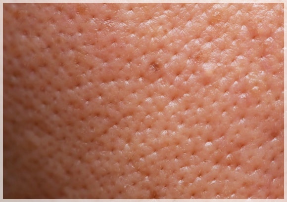 신촌역 피부과, 첫 피부 시술은 무엇부터 받아야 할까요? 관련 이미지 2