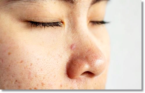 Why Are There So Many Reviews of LDM Skin Care in Hongdae? image 1