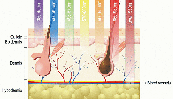 Check the Key Factors That Determine the Effectiveness of Sinchon Laser Hair Removal image 4