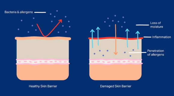 If You Get Sinchon Rejuran With Pain Relief, Does It Really Not Hurt? image 6