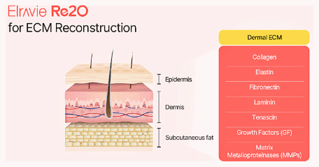 Hongdae Ritwo: Why It Is Difficult to Judge Its Effects Based Only on Photos After One Treatment image 2