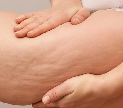 홍대바디온다, 운동해도 그대로인 군살이 고민이라면? 관련 이미지 3