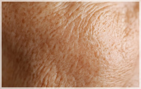 Potenza and Exosome Combination: What Skin Is It Effective For? image 8