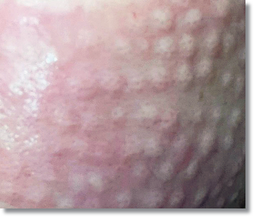 포텐자 리쥬란 같이 받을 수 있나요? 관련 이미지 7