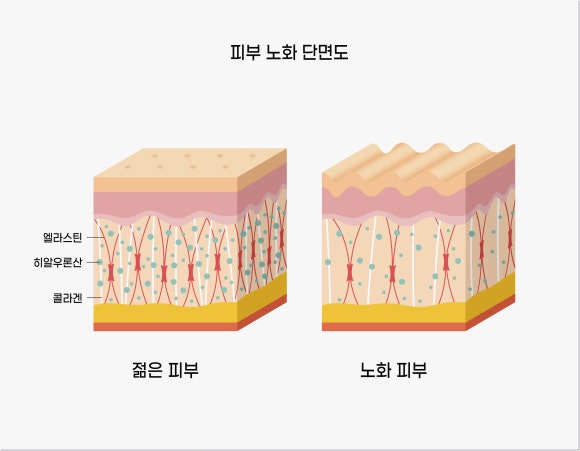 브이로어드밴스 리프팅, 왜 요즘 인기일까? 관련 이미지 2
