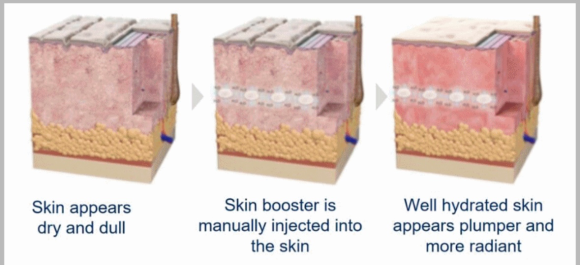 Hongdae Skin Booster: If You’re Debating Which Clinic to Go To image 2