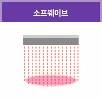 Shinchon Station Dermatology Clinic: How Sofwave Differs from Conventional Ultrasound Lifting image 4