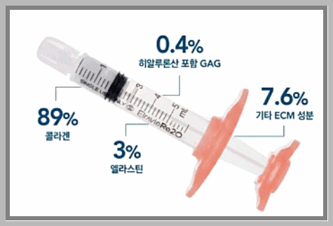 Hongdae Ritwo: Why It Is Difficult to Judge Its Effects Based Only on Photos After One Treatment image 8