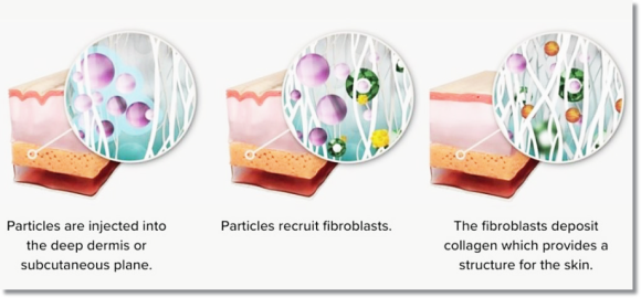If You Get Sinchon Rejuran With Pain Relief, Does It Really Not Hurt? image 2