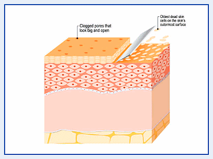 Sinchon Acne Dermatology Clinic: Why Treatment Order Matters image 6