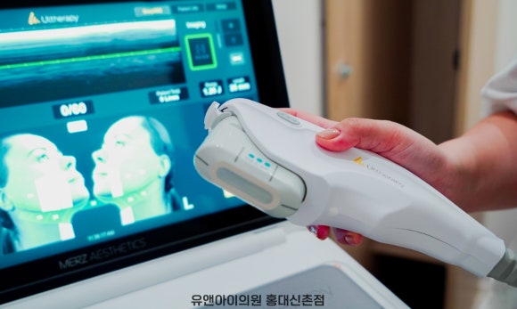 Hongdae Ultherapy PRIME: Should People with a Peanut-Shaped Face and Hollowed Cheeks Avoid It? image 5