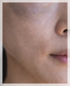 Dermatology Clinic Near Sinchon Station: Care Standards to Check Before Side Effects image 2