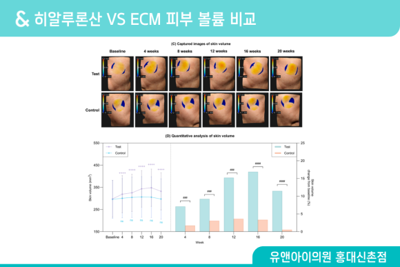 홍대 스킨부스터 종류 많은데, 내 피부엔 뭐가 맞을까 관련 이미지 6