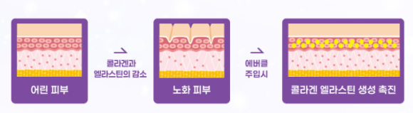 에버클 스킨부스터, 후기처럼 효과를 얻을 수 있을까? 관련 이미지 5