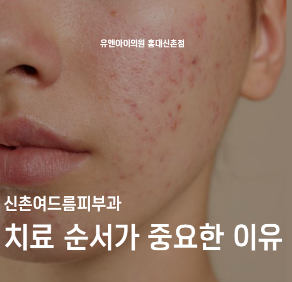 Sinchon Acne Dermatology Clinic: Why Treatment Order Matters image 1