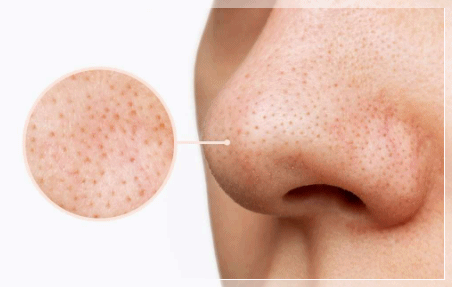 Dermatology Clinics in Mapo-gu, Seoul: 3 Criteria for Finding the Right Place for Your Concerns image 4