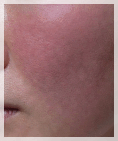 Dermatology Clinic Near Sinchon Station: Care Standards to Check Before Side Effects image 7
