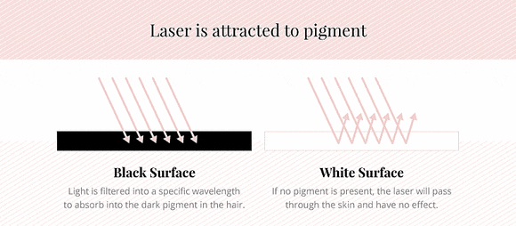 Frequently Asked Questions During a Shinchon Underarm Hair Removal Consultation: Number of Sessions and Pain, Organized image 7