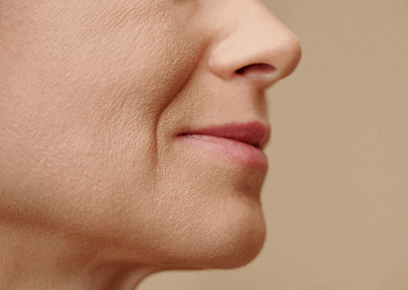 Can Onda Lifting at a Hongdae Dermatology Clinic Improve Nasolabial Folds and Sagging Jawlines? image 1