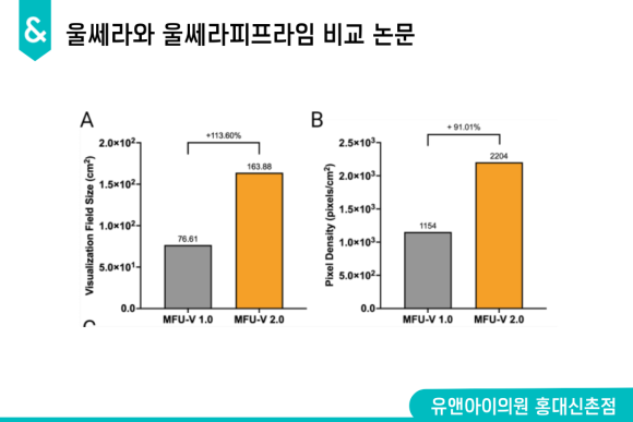 Hongdae Ulthera Prime Effects: Has the Precision Changed? image 2