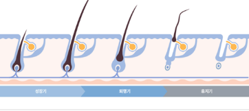 홍대레이저제모, 겨드랑이 제모로 계속 찾는 이유 관련 이미지 5