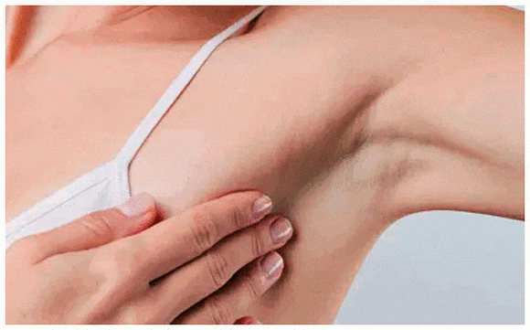 Sinchon Laser Hair Removal: Why a 5-Session Package May Not Be Enough image 1