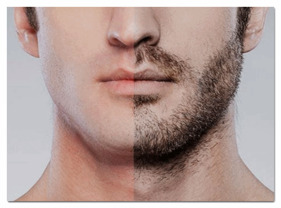 Sinchon Men’s Hair Removal: What Device Can Remove It Cleanly? image 1