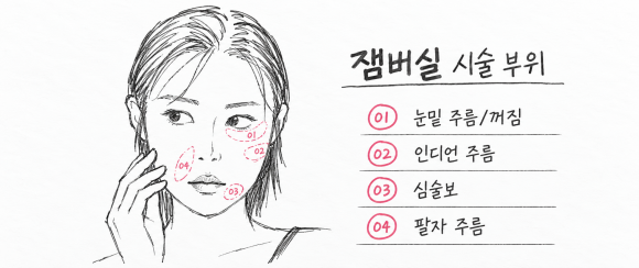 홍대실리프팅, 꺼진 부위도 채울 수 있을까? 잼버실 시술 원리와 주의사항 관련 이미지 4