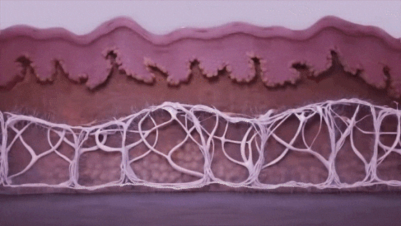 Considering Sinchon InMode or Ultherapy?! image 2