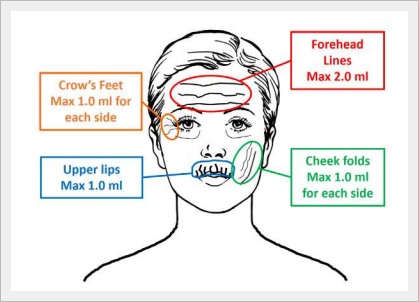 홍대이마필러 잘하는 곳은 뭐가 다를까? 관련 이미지 3