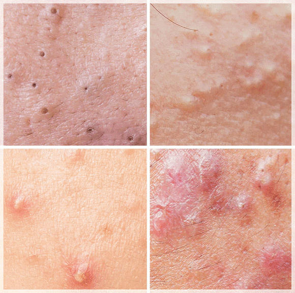 3 Things to Watch Out for When Reading Recommended Dermatology Reviews in Mapo-gu image 4