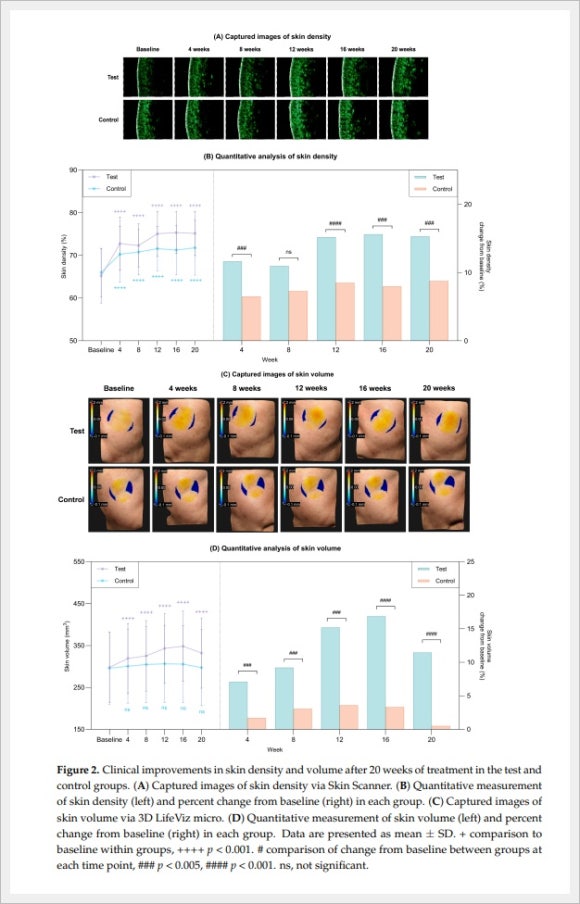 Hongdae Rituo: How Does It Compare with Aqua Shine Injections in Terms of Results? image 4
