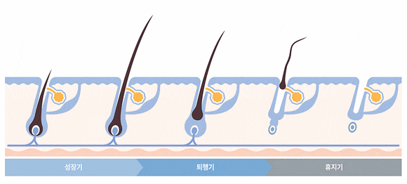 Check the Key Factors That Determine the Effectiveness of Sinchon Laser Hair Removal image 2