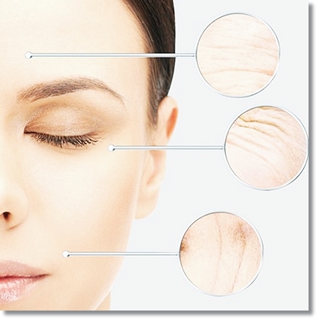 If You Get Sinchon Rejuran With Pain Relief, Does It Really Not Hurt? image 1