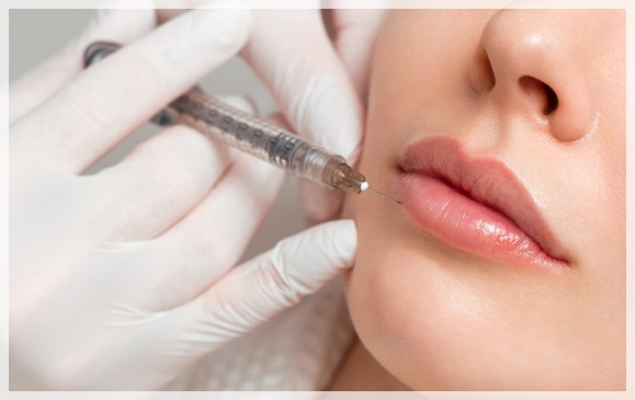 Hongdae Lip Filler: What Shape Is Right for My Lips? image 4
