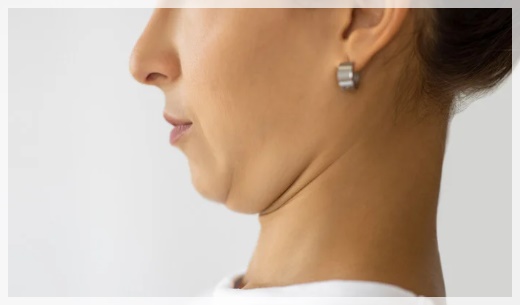 홍대온다리프팅 얼굴? 바디? 어디에 받을까? 관련 이미지 3
