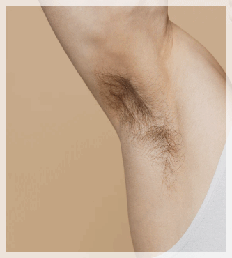 Hongdae Underarm Hair Removal: 3 Factors That Determine Satisfaction image 4