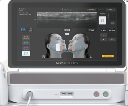 Sinchon Lifting: What Are the Jawline Improvement Effects of Ultherapy Prime? image 4