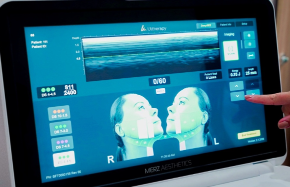 Sinchon Lifting: What Are the Jawline Improvement Effects of Ultherapy Prime? image 3
