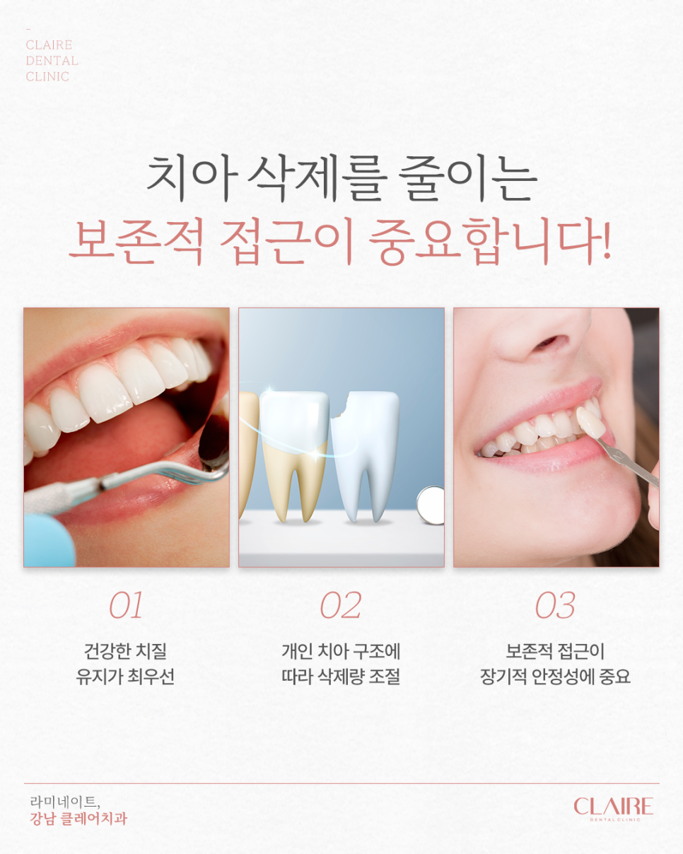 Gangnam Laminate Dental Clinic: Laminate for Natural Aesthetic Restorations image 3