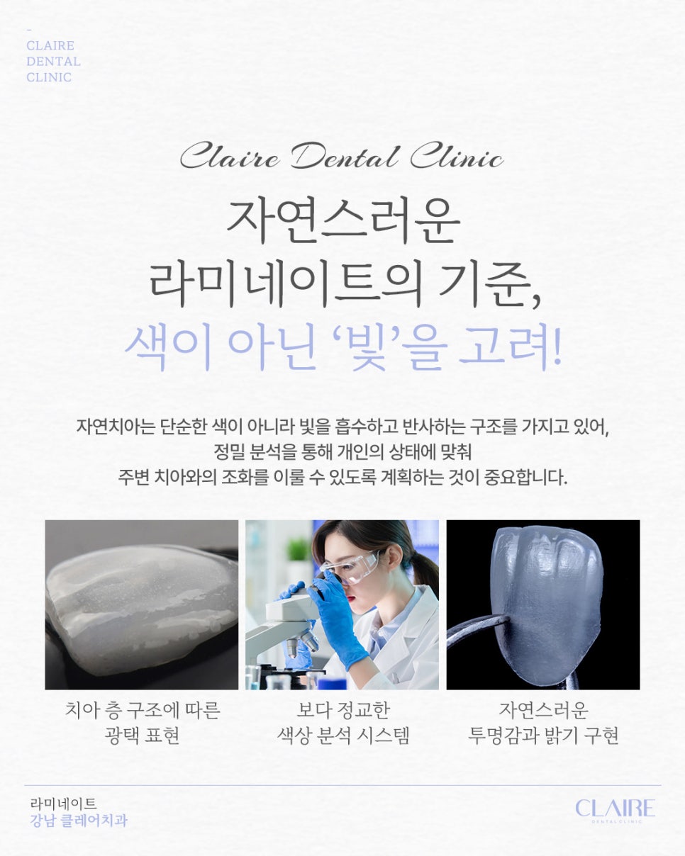 삼성동라미네이트 자연스러움을 위해 관련 이미지 9