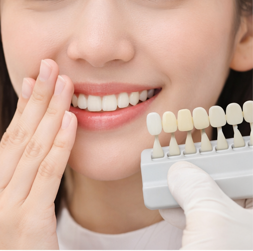 대치동 치아미백| 다들 미백부터 하라고 하는 이유(클레어치과) 관련 이미지 1