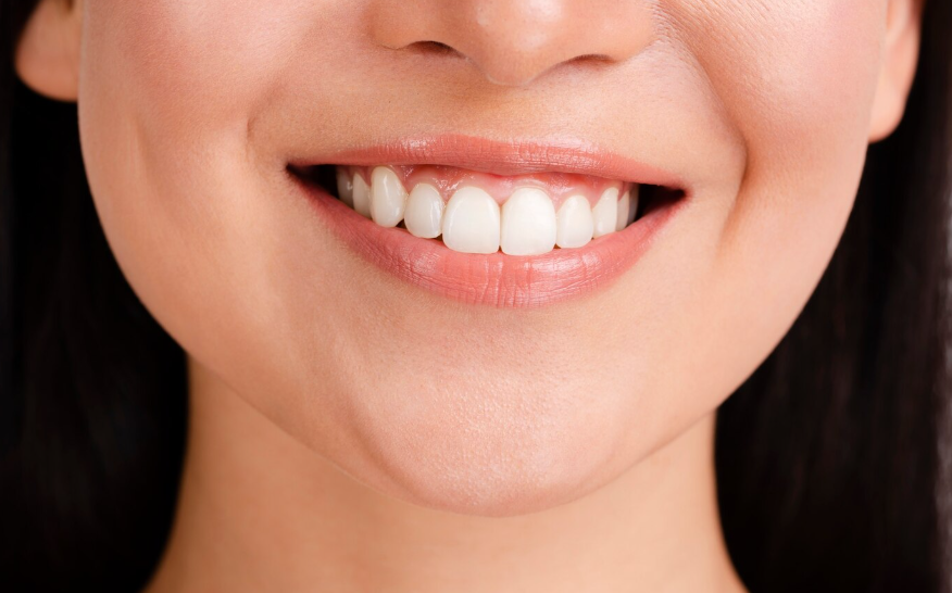 Accurate Criteria for Tooth Reshaping Without Removal image 1