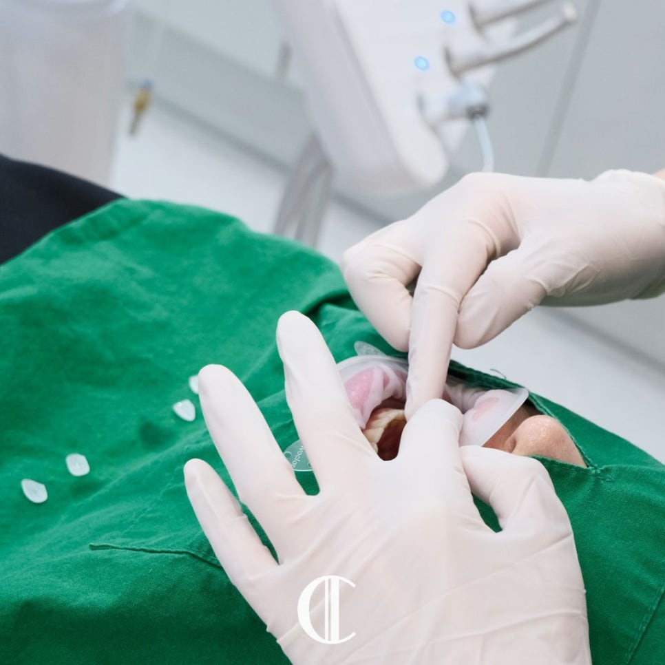 When One-Day Veneers Are Needed and Why Teeth Turn Yellow | Dogok-dong Dental Clinic image 10