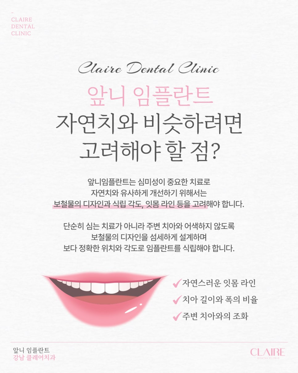 역삼동앞니임플란트 고려해야 할 포인트 관련 이미지 3