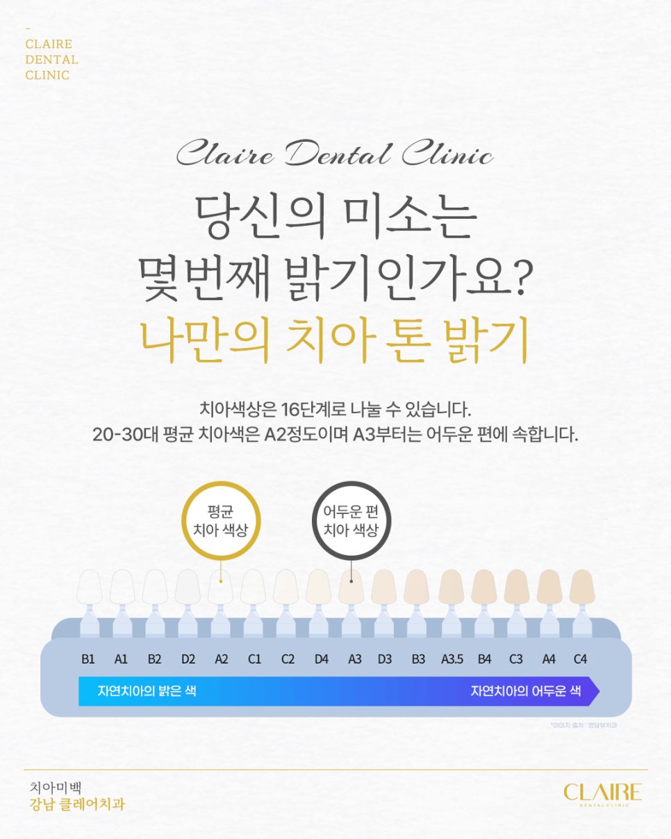 누렇게 변색된 앞니, 삼성동치아미백 으로 개선 관련 이미지 3