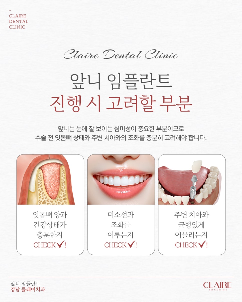 대치동앞니임플란트 왜 더 정교한 과정이 필요할까? 관련 이미지 4