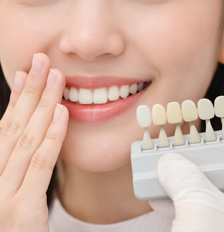 강남치아미백, 치아 색만 정리했을 뿐인데 인상이 달라졌습니다 | 선릉치아미백 관련 이미지 1