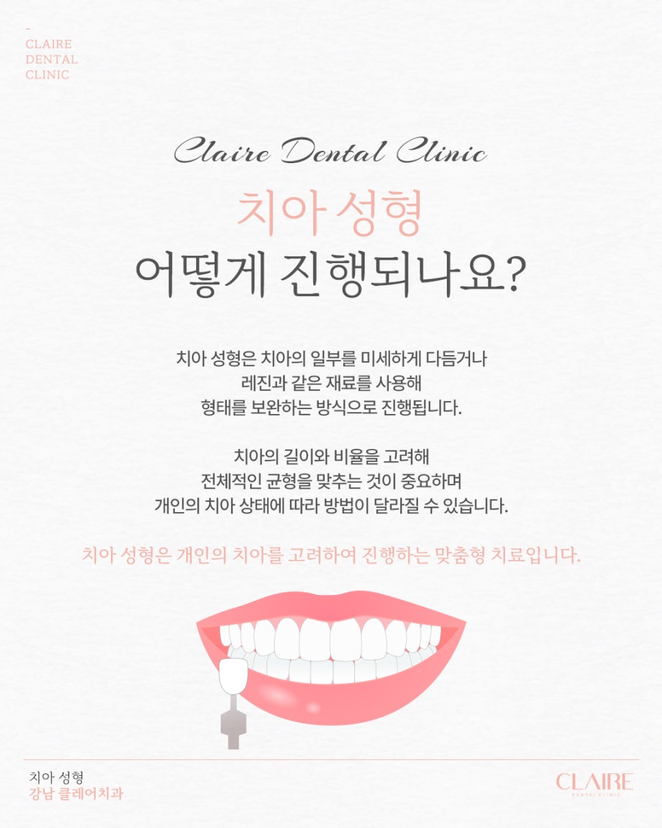 선릉역치과 앞니 모양이 고민이라면 치아 성형으로! 관련 이미지 8